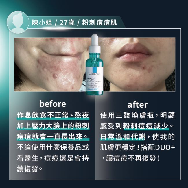 理膚寶水極效三重酸煥膚精華30ml