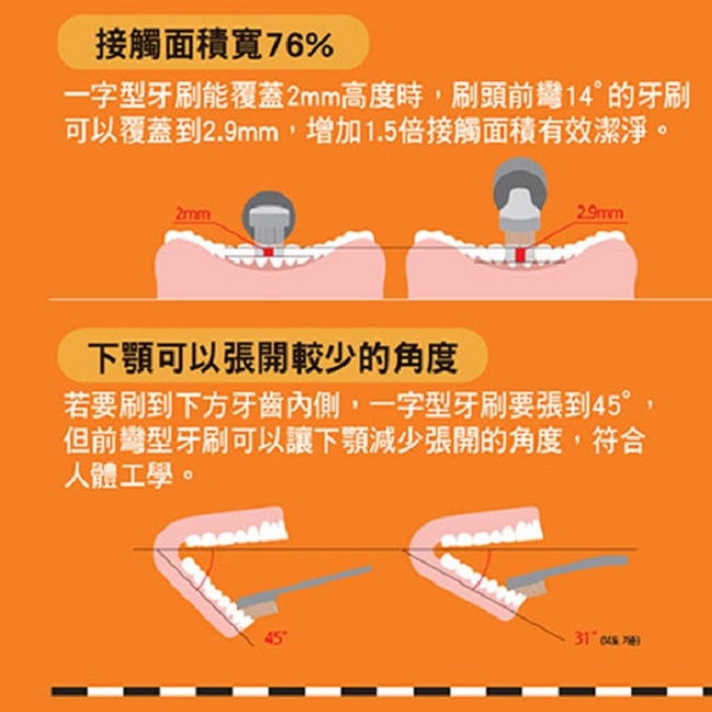 麗奇14°牙周對策牙刷(3.5mm彈力細軟毛)