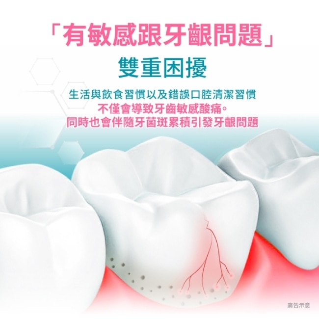 高露潔抗敏專家抗敏護齦雙效牙膏110g