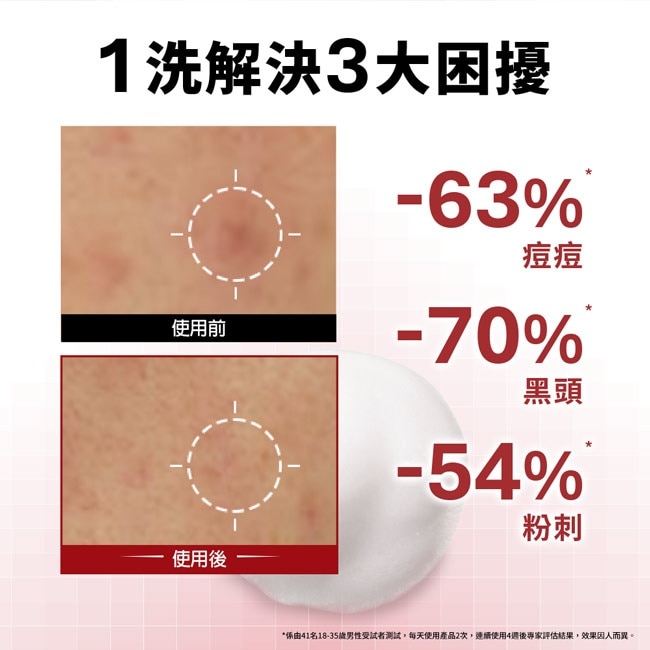 巴黎萊雅火山泥抗痘洗面乳100ml image