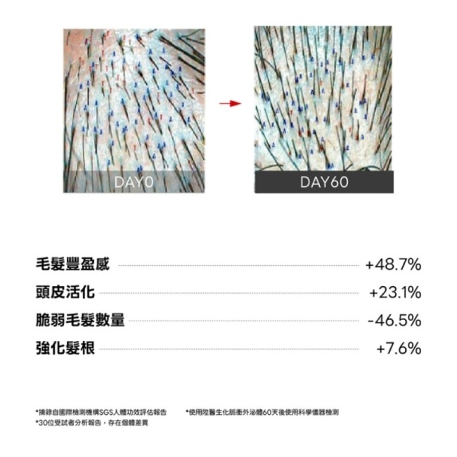 LA EXO 萊泌兒星耀999外泌體養髮液30ml(陞醫生技原廠外泌體保養品牌) image